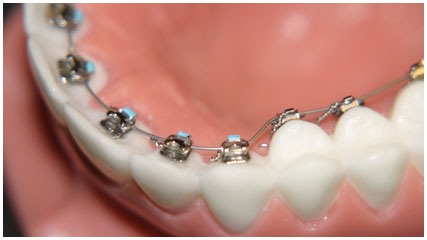 orthodontics image